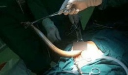 女主播塞黄鳝新闻,黄鳝惊现镜头，网络舆论哗然